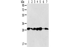 Gel: 8 % SDS-PAGE,Lysate: 40 μg,Lane 1-7: Jurkat cells, Hela cells, 293T cells, 231 cells, HepG2 cells, Human normal liver tissue, Human bladder carcinoma tissue,Primary antibody: ABIN7128021(SRPRB Antibody) at dilution 1/500 dilution,Secondary antibody: Goat anti rabbit IgG at 1/8000 dilution,Exposure time: 5 seconds (SRPRB anticorps)