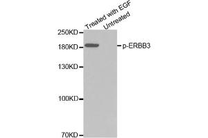 Western blot analysis of extracts from A431 cells using Phospho-ERBB3-Y1328 Antibody. (ERBB3 anticorps  (pTyr1328))