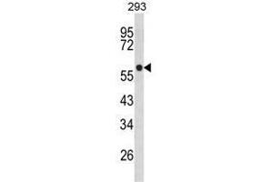 Western blot analysis of TPH1 Antibody (N-term) in 293 cell line lysates (35ug/lane). (Tryptophan Hydroxylase 1 anticorps  (N-Term))