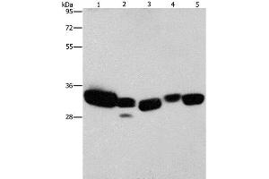 Western Blot analysis of Mouse liver and Human fetal lung tissue, hela cell and Mouse kidney tissue, Human brain malignant glioma tissue using CBR1 Polyclonal Antibody at dilution of 1:900 (CBR1 anticorps)