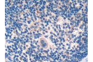 Detection of UCN2 in Mouse Spleen Tissue using Polyclonal Antibody to Urocortin 2 (UCN2)