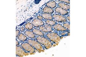 Immunohistochemistry of paraffin embedded rat colon using FCGBP (ABIN7073926) at dilution of 1:800 (250x lens) (FCGBP anticorps)