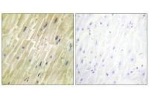 Immunohistochemistry analysis of paraffin-embedded human heart tissue using M-CK antibody.
