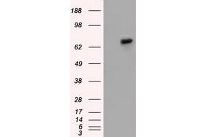 Western Blotting (WB) image for anti-Sorting Nexin 9 (SNX9) antibody (ABIN1501047)
