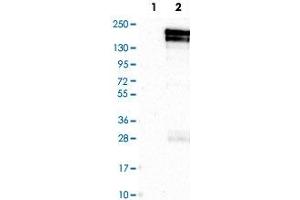 Western Blot analysis of Lane 1: negative control (vector only transfected HEK293T cell lysate) and Lane 2: over-expression lysate (co-expressed with a C-terminal myc-DDK tag in mammalian HEK293T cells) with KDM5B polyclonal antibody . (KDM5B anticorps)