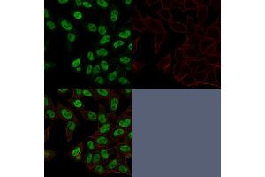 Confocal Immunofluorescence image of HeLa cells using Topo II alpha, Monoclonal Antibody (TOP2A/1362). (Topoisomerase II alpha anticorps  (AA 1352-1493))