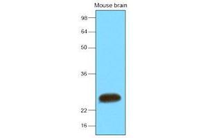 The extracts of mouse brain (30 ug) were resolved by SDS-PAGE, transferred to nitrocellulose membrane and probed with anti-human SNAP25 (1:2000). (SNAP25 anticorps  (AA 1-206))