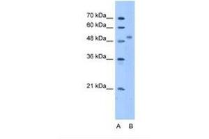 Image no. 1 for anti-Zinc Finger Protein 763 (ZNF763) (AA 51-100) antibody (ABIN341644) (ZNF763 anticorps  (AA 51-100))