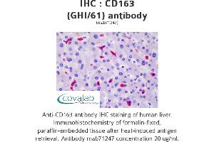 Image no. 3 for anti-CD163 (CD163) antibody (ABIN1721750) (CD163 anticorps)