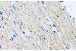 Immunohistochemistry of paraffin-embedded Mouse heart using HYAL1 Polyclonal Antibody at dilution of 1:100 (40x lens). (HYAL1 anticorps)