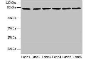 Western blot All lanes: CAPN1 antibody at 6 μg/mL Lane 1: A375 whole cell lysate Lane 2: 293T whole cell lysate Lane 3: PC-3 whole cell lysate Lane 4: Jurkat whole cell lysate Lane 5: Hela whole cell lysate Lane 6: A2780 whole cell lysate Secondary Goat polyclonal to rabbit IgG at 1/10000 dilution Predicted band size: 82 kDa Observed band size: 82 kDa (CAPNL1 anticorps  (Catalytic Subunit))