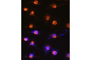 Immunofluorescence analysis of U-251 MG cells using S100B Rabbit pAb (ABIN3021047, ABIN3021048, ABIN3021049, ABIN1513496 and ABIN6213928) at dilution of 1:100 (40x lens).