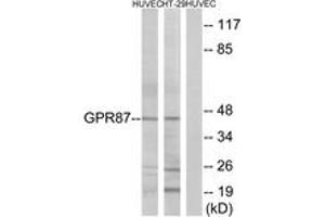 Western Blotting (WB) image for anti-G Protein-Coupled Receptor 87 (GPR87) (AA 221-270) antibody (ABIN2890880) (GPR87 anticorps  (AA 221-270))