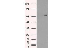 Western Blotting (WB) image for anti-Histone Deacetylase 10 (HDAC10) antibody (ABIN1498615) (HDAC10 anticorps)