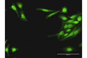 Immunofluorescence of purified MaxPab antibody to PLA2G16 on HeLa cell.