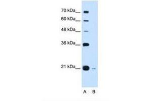 Image no. 2 for anti-DCTP Pyrophosphatase 1 (DCTPP1) (C-Term) antibody (ABIN6738241) (DCTPP1 anticorps  (C-Term))