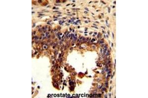 Immunohistochemistry (IHC) image for anti-Keratin 4 (KRT4) antibody (ABIN3002775)