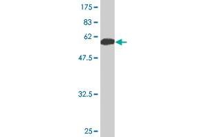 Western Blot detection against Immunogen (53. (14-3-3 sigma/SFN anticorps  (AA 1-248))