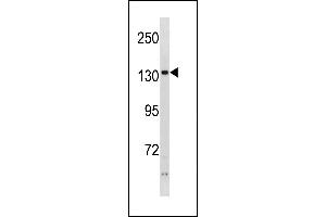PHKA2 Antibody (N-term) (ABIN1881651 and ABIN2843259) western blot analysis in ZR-75-1 cell line lysates (35 μg/lane). (PHKA2 anticorps  (N-Term))