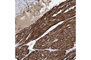 Immunohistochemical staining of human smooth muscle with RASGEF1A polyclonal antibody  shows strong cytoplasmic positivity in smooth muscle cells at 1:200-1:500 dilution. (RASGEF1A anticorps)