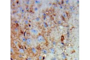 Used in DAB staining on fromalin fixed paraffin-embedded Brain tissue