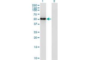 Western Blot analysis of FLI1 expression in transfected 293T cell line by FLI1 monoclonal antibody (M02), clone 2G8. (FLI1 anticorps  (AA 1-452))