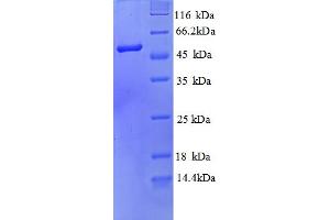 SDS-PAGE (SDS) image for Sep (O-phosphoserine) tRNA:Sec (Selenocysteine) tRNA Synthase (SEPSECS) (AA 5-451), (partial) protein (His tag) (ABIN5712916)