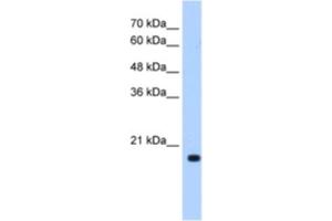 Western Blotting (WB) image for anti-DCTP Pyrophosphatase 1 (DCTPP1) antibody (ABIN2462971) (DCTPP1 anticorps)