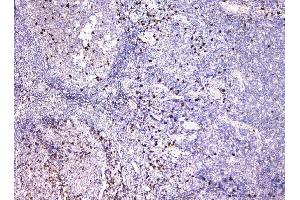 IHC analysis of IGLL1 using anti-IGLL1 antibody (ABIN6719329). (IGLL1 anticorps)