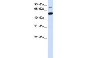 WB Suggested Anti-SMARCD1 Antibody Titration: 0. (SMARCD1 anticorps  (Middle Region))