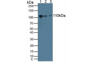 Western blot analysis of (1) Human A549 Cells, (2) Human HeLa cells and (3) Human Lung Tissue. (MVP anticorps  (AA 2-272))
