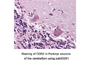 Image no. 1 for anti-Cerebellar Degeneration-Related Protein 2, 62kDa (CDR2) (C-Term) antibody (ABIN363590)