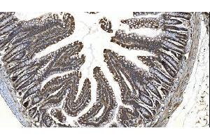 IHC analysis of YTHDF2 using anti-YTHDF2 antibody (ABIN7603191). (YTHDF2 anticorps  (N-Term))