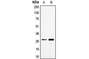 Western blot analysis of CD70 expression in Jurkat (A), NCIH460 (B) whole cell lysates. (CD70 anticorps  (Center))