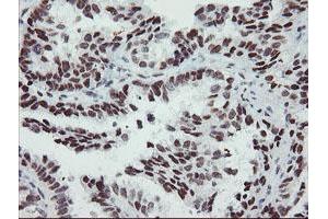 Image no. 9 for anti-SUMO1/sentrin/SMT3 Specific Peptidase 2 (SENP2) (AA 139-523) antibody (ABIN1490925)