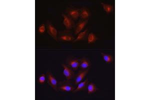Immunofluorescence analysis of U2OS cells using  Rabbit pAb (ABIN3020671, ABIN3020672, ABIN1512605 and ABIN6213659) at dilution of 1:100 (40x lens). (ATF6 anticorps  (AA 1-190))