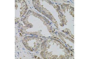 Immunohistochemistry of paraffin-embedded human prostate using VIP antibody (ABIN6292338) (40x lens).