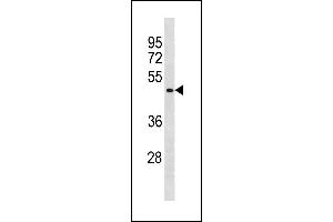 BCL6B Antibody (Center) (ABIN1881109 and ABIN2843280) western blot analysis in A549 cell line lysates (35 μg/lane). (BCL6B anticorps  (AA 276-302))