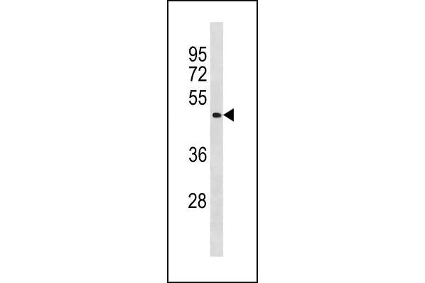 BCL6B Antikörper  (AA 276-302)