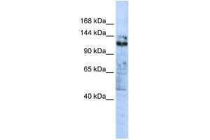 WB Suggested Anti-ZNF451 Antibody Titration:  0. (ZNF451 anticorps  (C-Term))