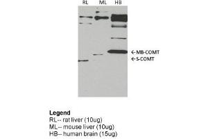 COMT antibody - middle region  validated by WB using rat liver, mouse lung, human brain at 1:1000. (COMT anticorps  (Middle Region))