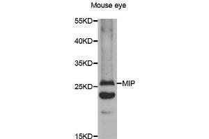 Western blot analysis of extracts of mouse eyes tissue lysate, using MIP antibody. (MIP anticorps)