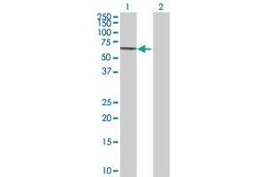 Lane 1: MSLN transfected lysate ( 68.