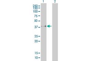 Western Blot analysis of FCGR2B expression in transfected 293T cell line by FCGR2B monoclonal antibody (M01), clone 2E10.