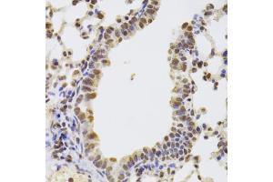 Immunohistochemistry of paraffin-embedded mouse lung using AAAS Antibody. (Adracalin anticorps)