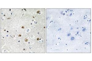 Immunohistochemistry analysis of paraffin-embedded human brain tissue using TF3B antibody. (BRF1 anticorps  (Internal Region))