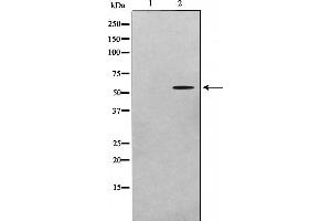 Western blot analysis on A549 cell lysate using ADCK1 Antibody,The lane on the left is treated with the antigen-specific peptide. (ADCK1 anticorps  (Internal Region))