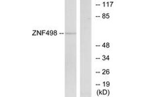 Western blot analysis of extracts from COS7 cells, using ZNF498 Antibody. (Zinc Finger and SCAN Domain Containing 25 (ZSCAN25) (AA 331-380) anticorps)