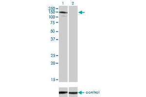 Western blot analysis of ABL2 over-expressed 293 cell line, cotransfected with ABL2 Validated Chimera RNAi (Lane 2) or non-transfected control (Lane 1). (ABL2 anticorps  (AA 743-842))