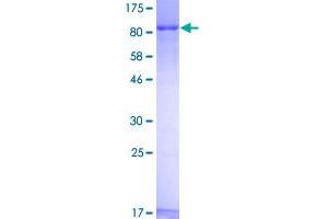 Image no. 1 for Zyxin (ZYX) (AA 1-572) protein (GST tag) (ABIN1326572)